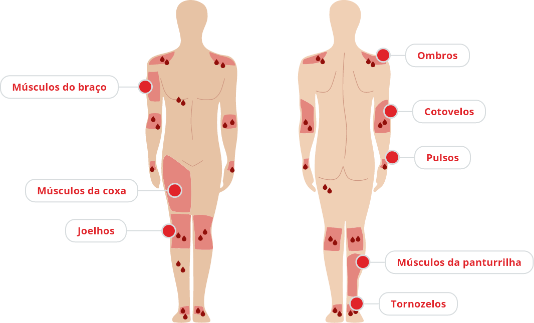 Sintomas da hemofilia
